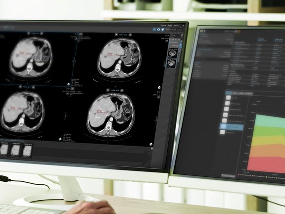 Auswertung von Bilddaten in einer Studie zur Prüfung von Immuntherapeutika im Kontext von iRECIST
