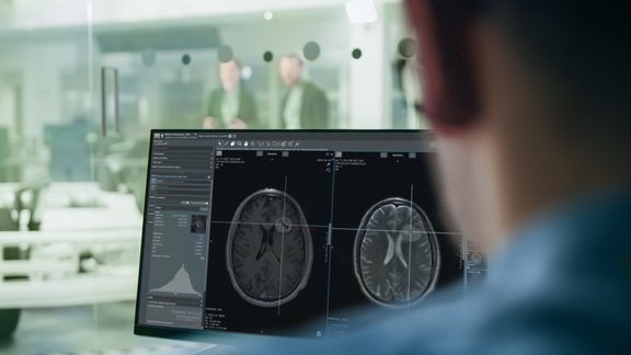 A picture of a person looking at a brain scan and the interface of mint Lesion™  on a computer